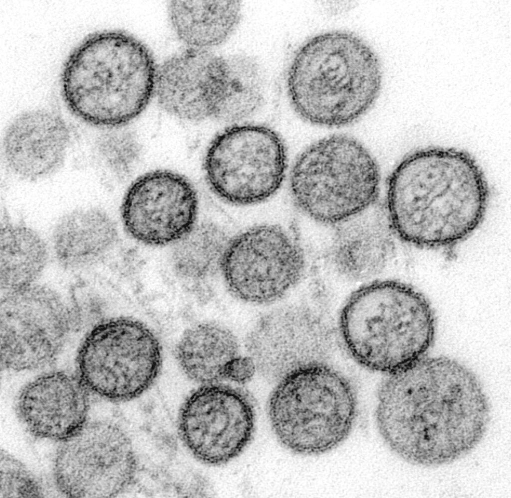 hantavirus y ratas